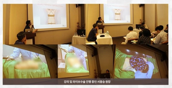[라이브수술 워크샵] 세계 각국 30여명의 해외의료진들을 대상으로 한 라이브수술 워크샵 - 16 - 더라인성형외과