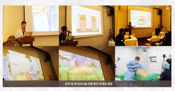 [라이브수술 워크샵] 세계 각국 30여명의 해외의료진들을 대상으로 한 라이브수술 워크샵 - 19 - 더라인성형외과