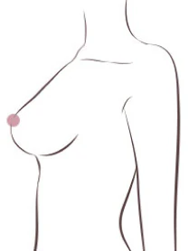 정상 가슴 - 가슴 밑선에서 유두가 4~5cm 위 - 더라인성형외과