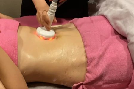 수술 후 고주파 라인 정리 및 붓기 완화 치료 - 더라인성형외과