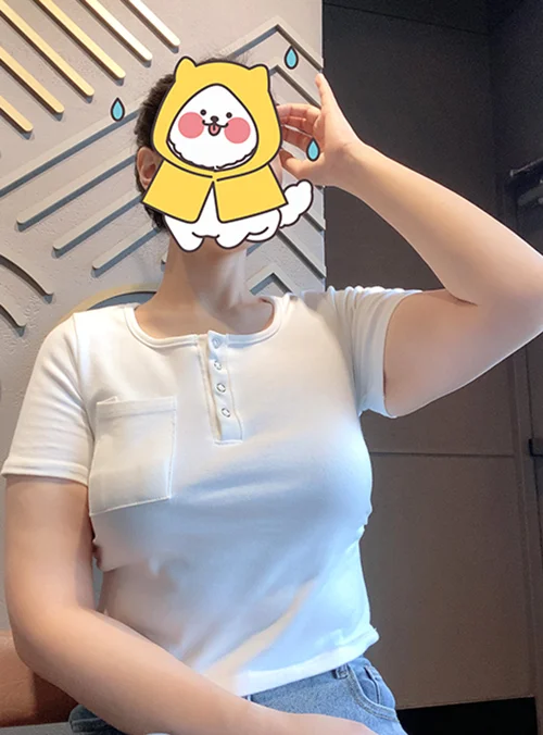 줄기세포가 풍부한 SVF 팔 거상 - 3 - 더라인성형외과