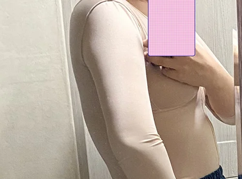 줄기세포가 풍부한 SVF 팔 거상 - 4 - 더라인성형외과