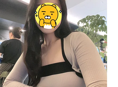 줄기세포가 풍부한 SVF 팔 거상 - 5 - 더라인성형외과