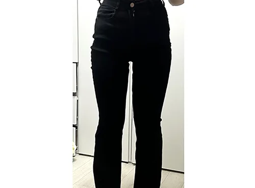 줄기세포가 풍부한 SVF 허벅지 지방흡입 - 4 - 더라인성형외과