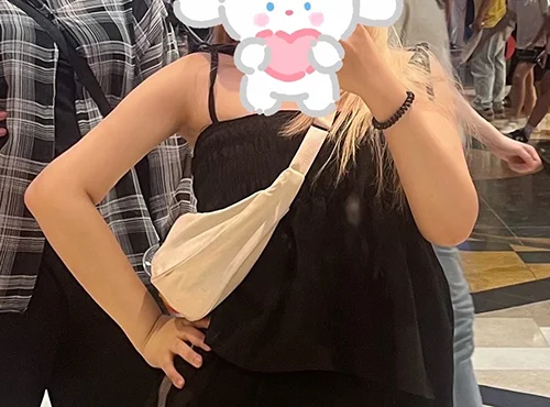 줄기세포가 풍부한 SVF 팔 지방흡입+ 팔거상 - 6 - 더라인성형외과