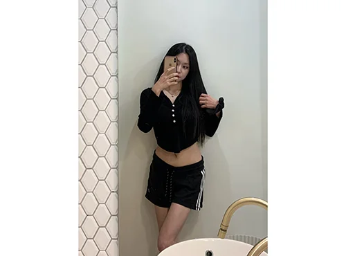 줄기세포가 풍부한 SVF 허골승 (허벅지지방흡입, 승마살지방흡입, 복부 지방흡입, 골반+엉덩이지방이식) - 9 - 더라인성형외과