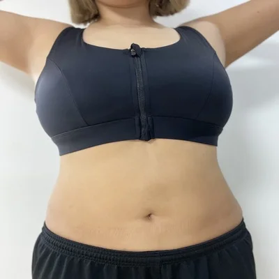 줄기세포가 풍부한 SVF 복부 지방흡입 (복부+러브핸들) - 3 - 더라인성형외과