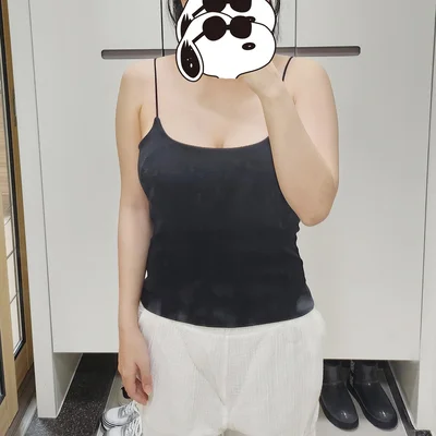 줄기세포가 풍부한 SVF 팔 지방흡입 - 2 - 더라인성형외과