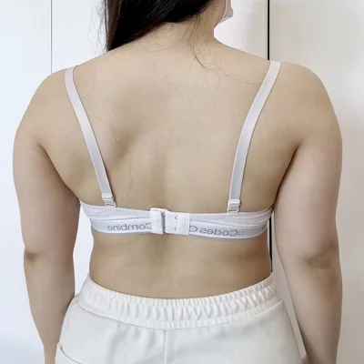 줄기세포가 풍부한 SVF 팔 지방흡입 - 3 - 더라인성형외과