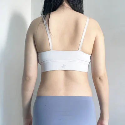 줄기세포가 풍부한 SVF 복부 지방흡입 - 6 - 더라인성형외과