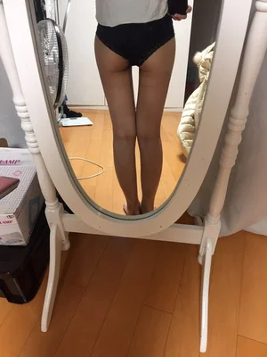 줄기세포가 풍부한 SVF 허벅지 지방흡입 - 3 - 더라인성형외과