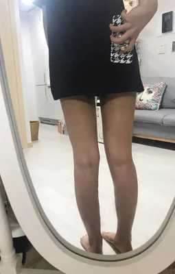줄기세포가 풍부한 SVF 허벅지 지방흡입 - 4 - 더라인성형외과