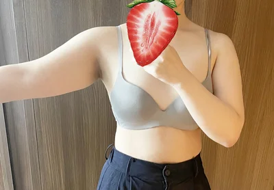 줄기세포가 풍부한 SVF 팔 지방흡입 - 2 - 더라인성형외과
