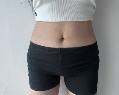줄기세포가 풍부한 SVF 복부+코르셋 지방흡입 - 5 - 더라인성형외과