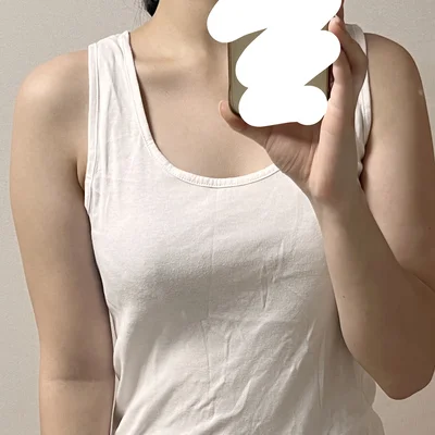 줄기세포가 풍부한 SVF 팔 지방흡입 - 2 - 더라인성형외과