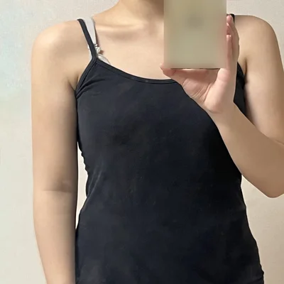 줄기세포가 풍부한 SVF 팔 지방흡입 - 5 - 더라인성형외과