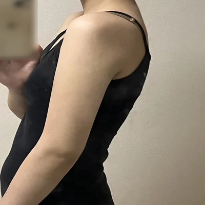 줄기세포가 풍부한 SVF 팔 지방흡입 - 6 - 더라인성형외과