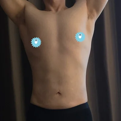 줄기세포가 풍부한 SVF 남자 복부 지방흡입 (복부+코르셋+여유증) - 4 - 더라인성형외과