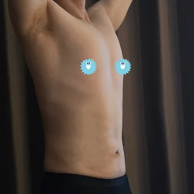 줄기세포가 풍부한 SVF 남자 복부 지방흡입 (복부+코르셋+여유증) - 5 - 더라인성형외과