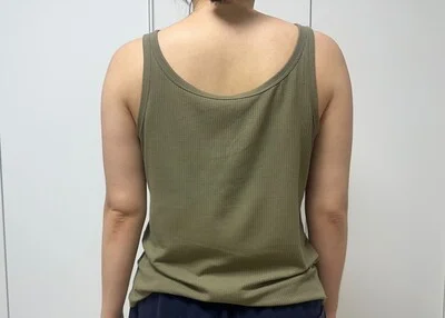 줄기세포가 풍부한 SVF 팔 지방흡입 (팔 270도+팔뿌리) - 5 - 더라인성형외과