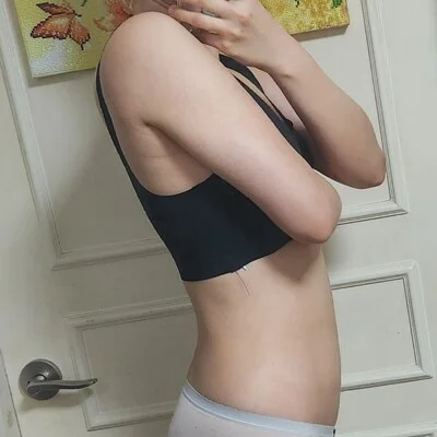 줄기세포가 풍부한 SVF 복부+팔 지방흡입 - 3 - 더라인성형외과