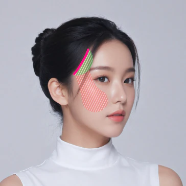2030 미니 동안 거상 스마스 밑 박리 범위 - 더라인성형외과