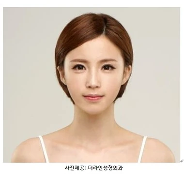 내게 딱 맞는 맞춤 눈성형…트임·눈매교정 여부 진단받을까 - 1 - 더라인성형외과