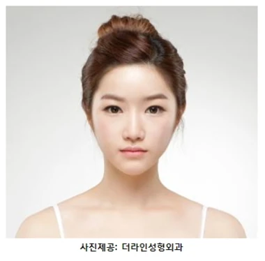 수술 ‘티’ 없이 시원한 눈…눈성형 시 얼굴 조화 고려해야 - 1 - 더라인성형외과