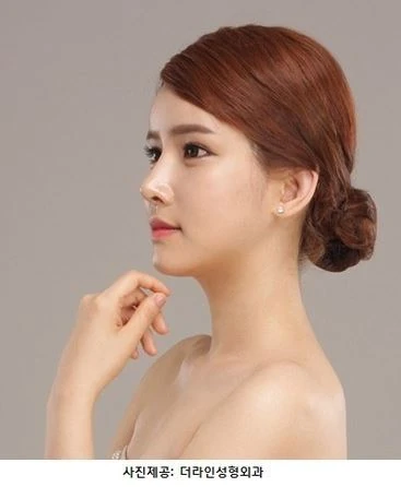 ‘내 것’처럼 자연스러운 바비코성형 ”얼굴 조화부터 고려해야” - 1 - 더라인성형외과