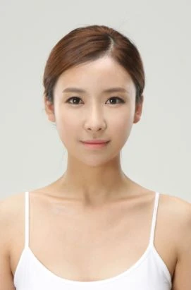 ‘내 눈 같은’ 자연스러운 눈성형 가능한 쌍꺼풀수술은 - 1 - 더라인성형외과