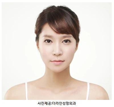 눈 재수술도 얼굴 조화 고려해야…내 눈을 위한 맞춤 수술방법은 - 1 - 더라인성형외과