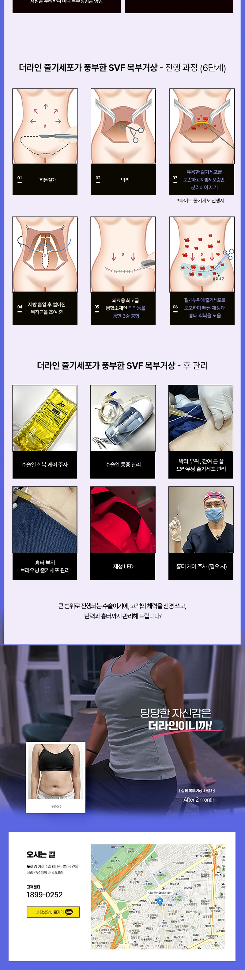 원데이 처진 복부 2