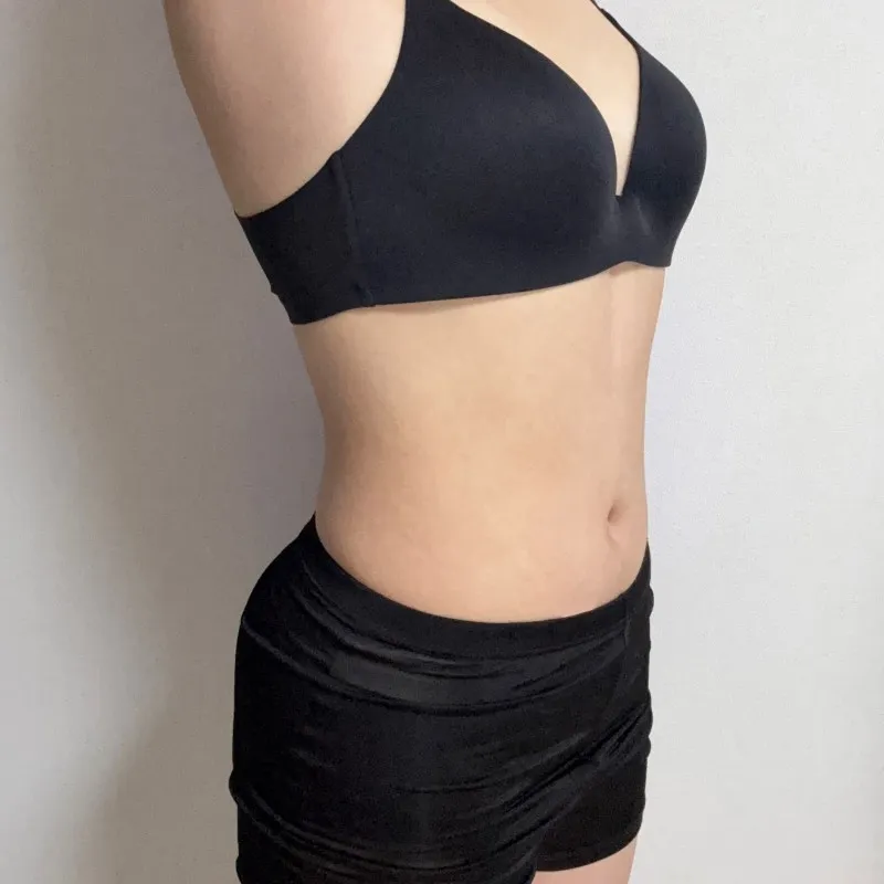 Abdominal Lipo + Breast Fat Transfer - Abdominal Liposuction (Upper Body) surgery After photo - TheLINE Plastic Surgery