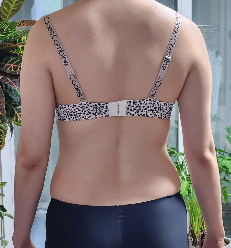 Abdomen and love handle liposuction!!! - Abdominal Liposuction (Upper Body) Before 2 - TheLINE Plastic Surgery