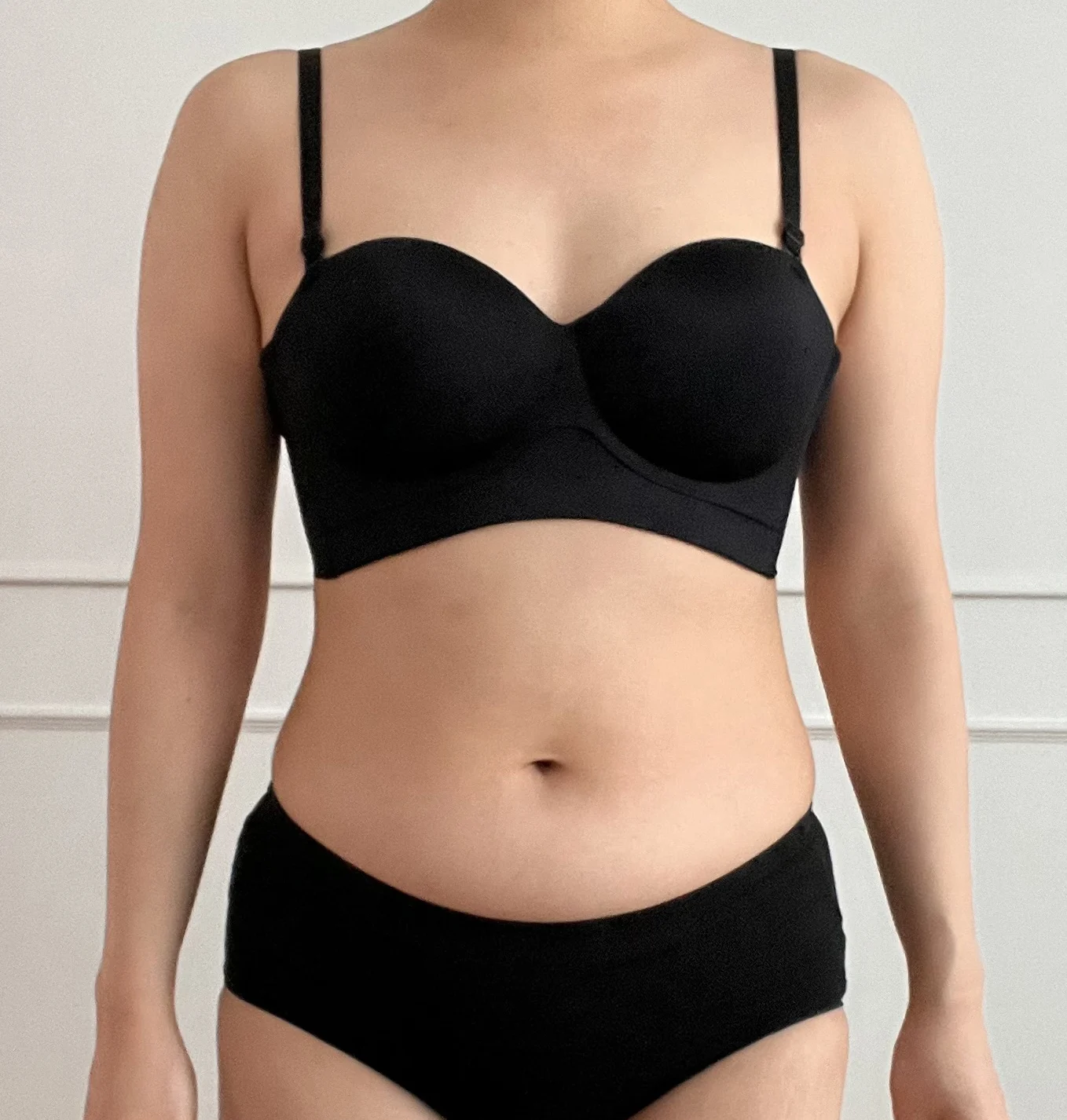 Abdomen and upper arm lipo review at 3 m - Arm Liposuction Before 2 - TheLINE Plastic Surgery