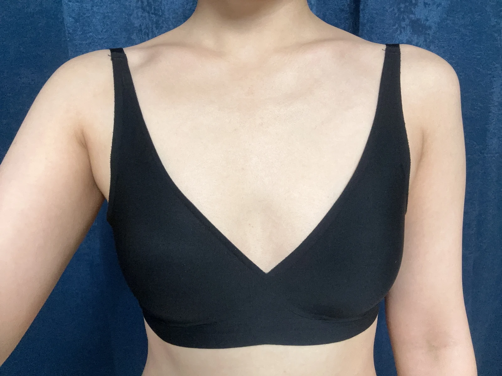 My stem cell breast fat grafting review! - Breast Fat Grafting Before 2 - TheLINE Plastic Surgery
