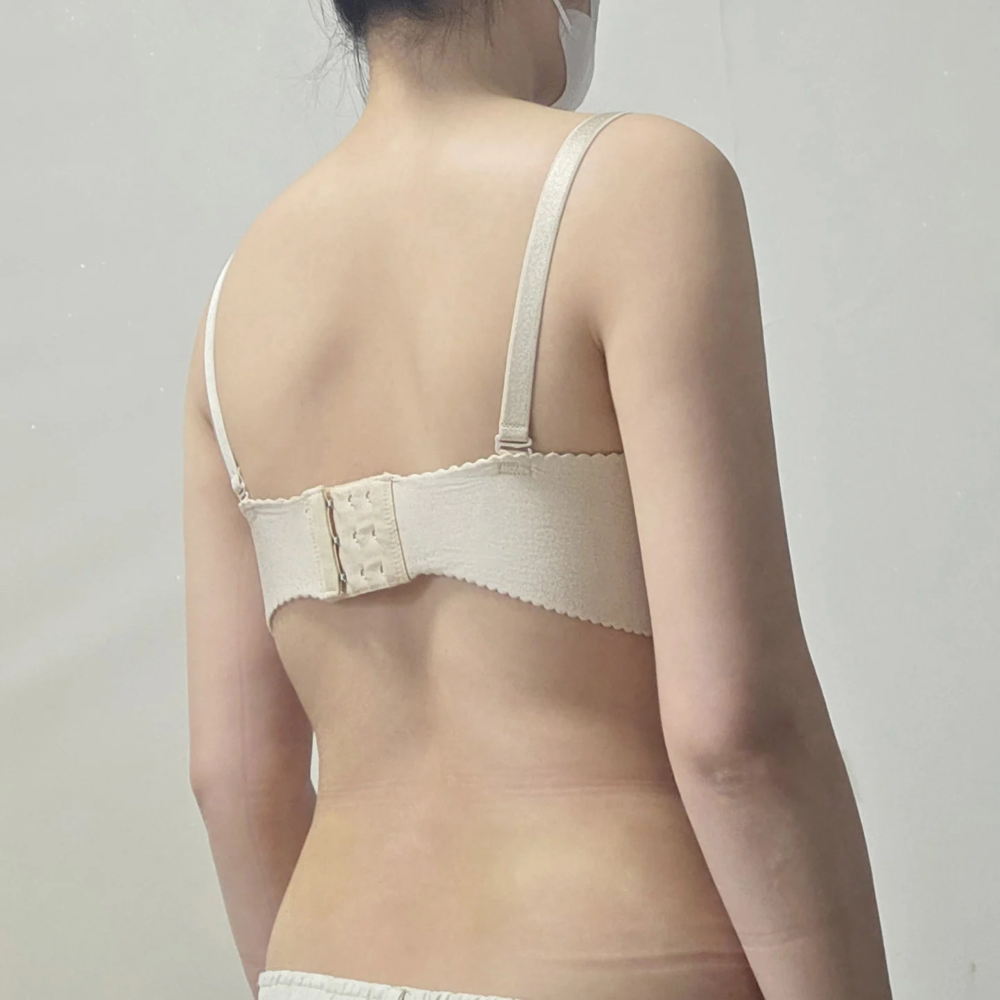 Exactly one month since my arm liposucti - Arm Liposuction surgery After photo - TheLINE Plastic Surgery