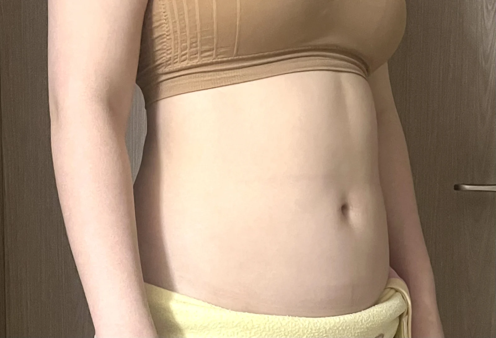 Abdomen and Love Handle Lipo, Totally Re - Abdominal Liposuction (Upper Body) Before 2 - TheLINE Plastic Surgery