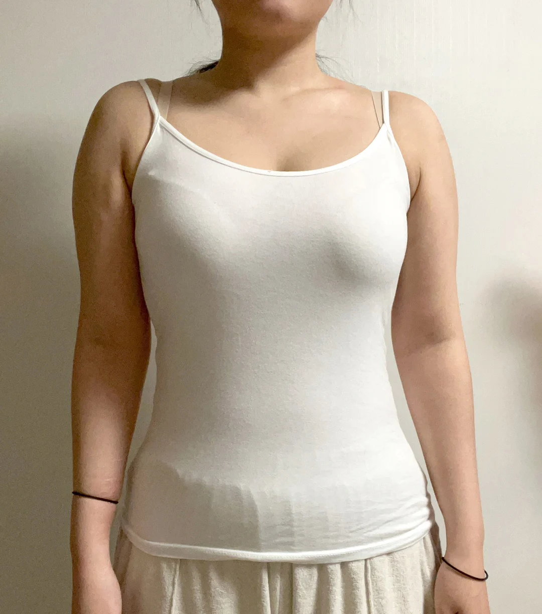 Truly the Best!! - Arm Liposuction Before 2 - TheLINE Plastic Surgery