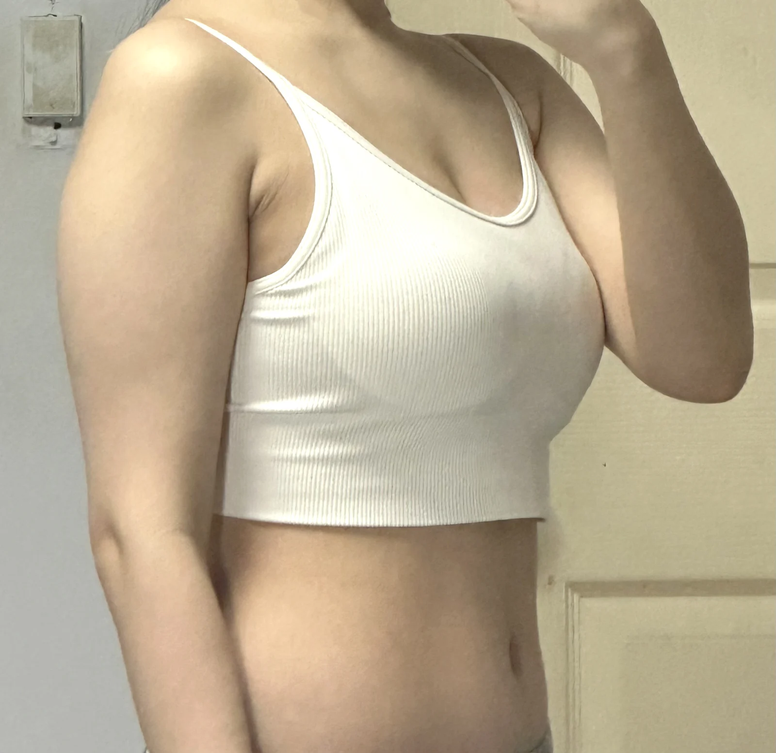 Slender Arm Transformation Review♥ - Arm Liposuction Before 2 - TheLINE Plastic Surgery