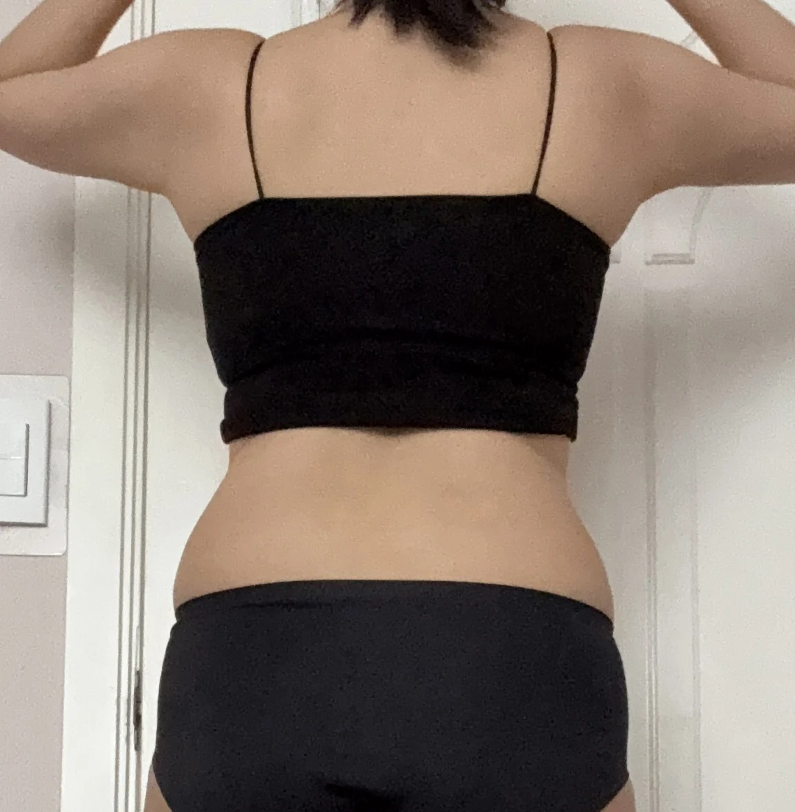 It keeps going down, haha - Abdominal Liposuction (Upper Body) Before 2 - TheLINE Plastic Surgery