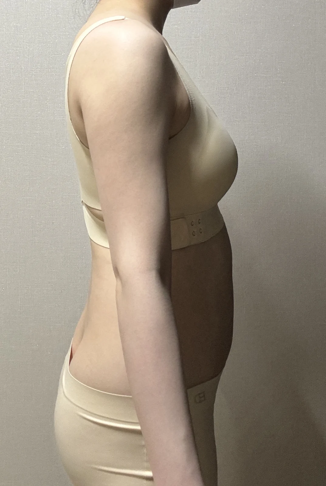 Dr. Yoongeun Kim - upper arm, abdomen an - Breast Fat Grafting Before 2 - TheLINE Plastic Surgery
