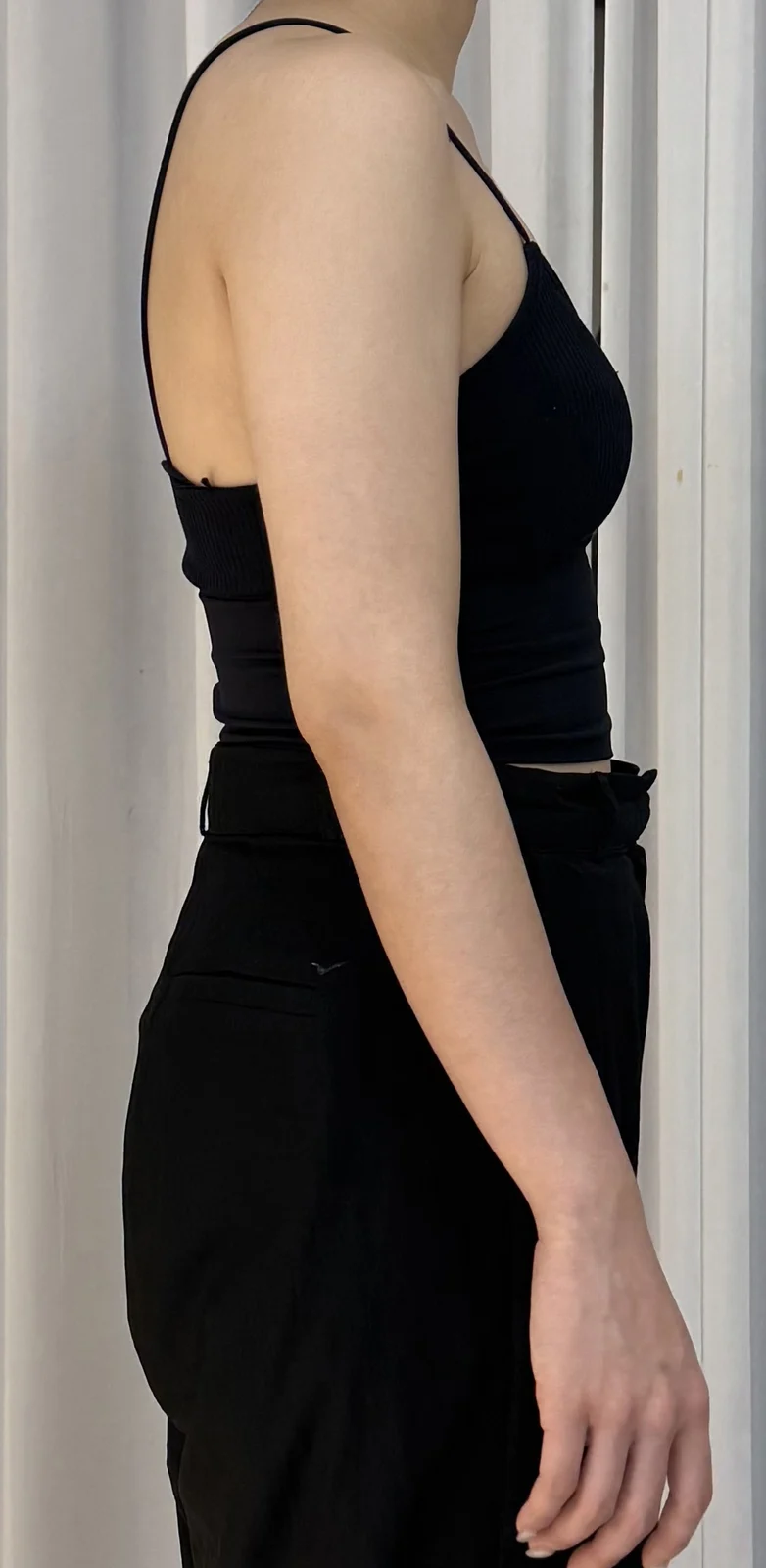Arm liposuction review, so happy with it - Arm Liposuction After 4 - TheLINE Plastic Surgery