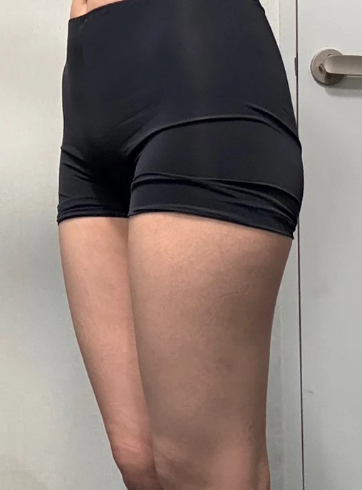 Thigh 360, Chanel line liposuction and h - Hip Fat Grafting Before 2 - TheLINE Plastic Surgery
