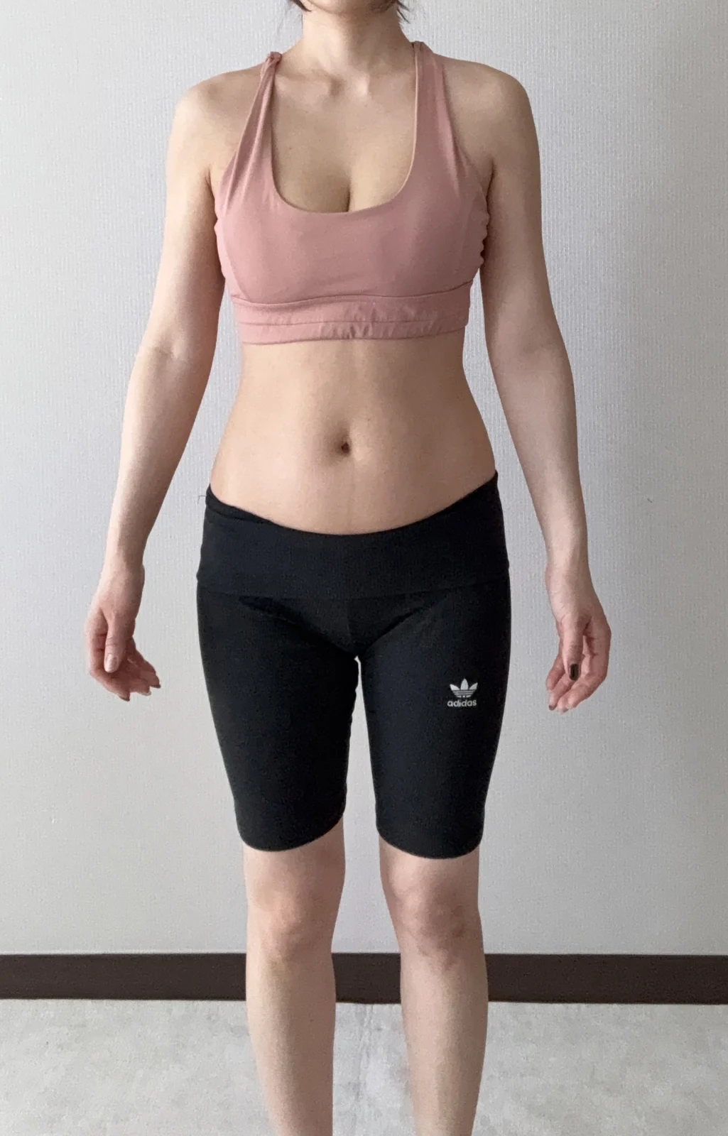 Sharing my three-month review of arm, ab - Arm Liposuction Before 2 - TheLINE Plastic Surgery