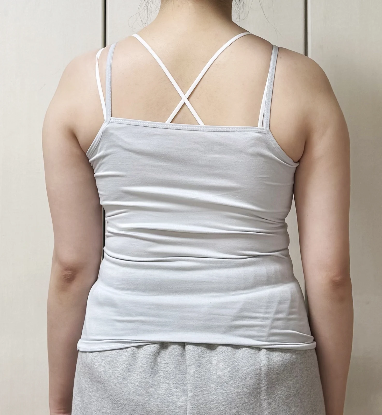 Arm six-month review ♥ - Arm Liposuction Before 2 - TheLINE Plastic Surgery