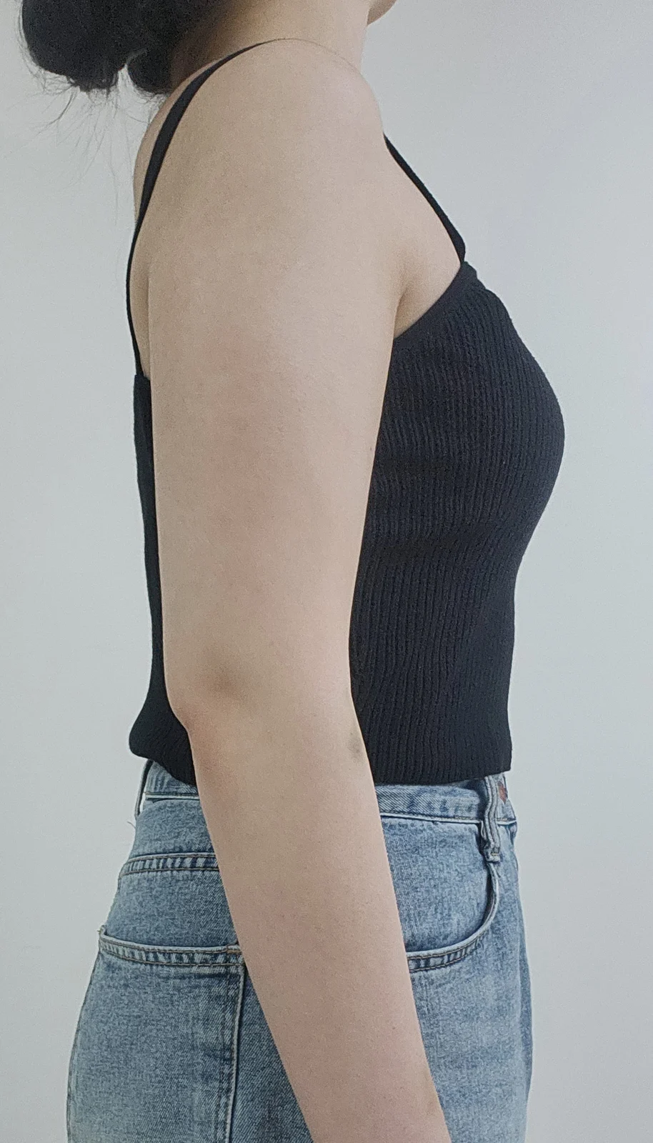More satisfied as time goes on!! - Arm Liposuction Before 2 - TheLINE Plastic Surgery