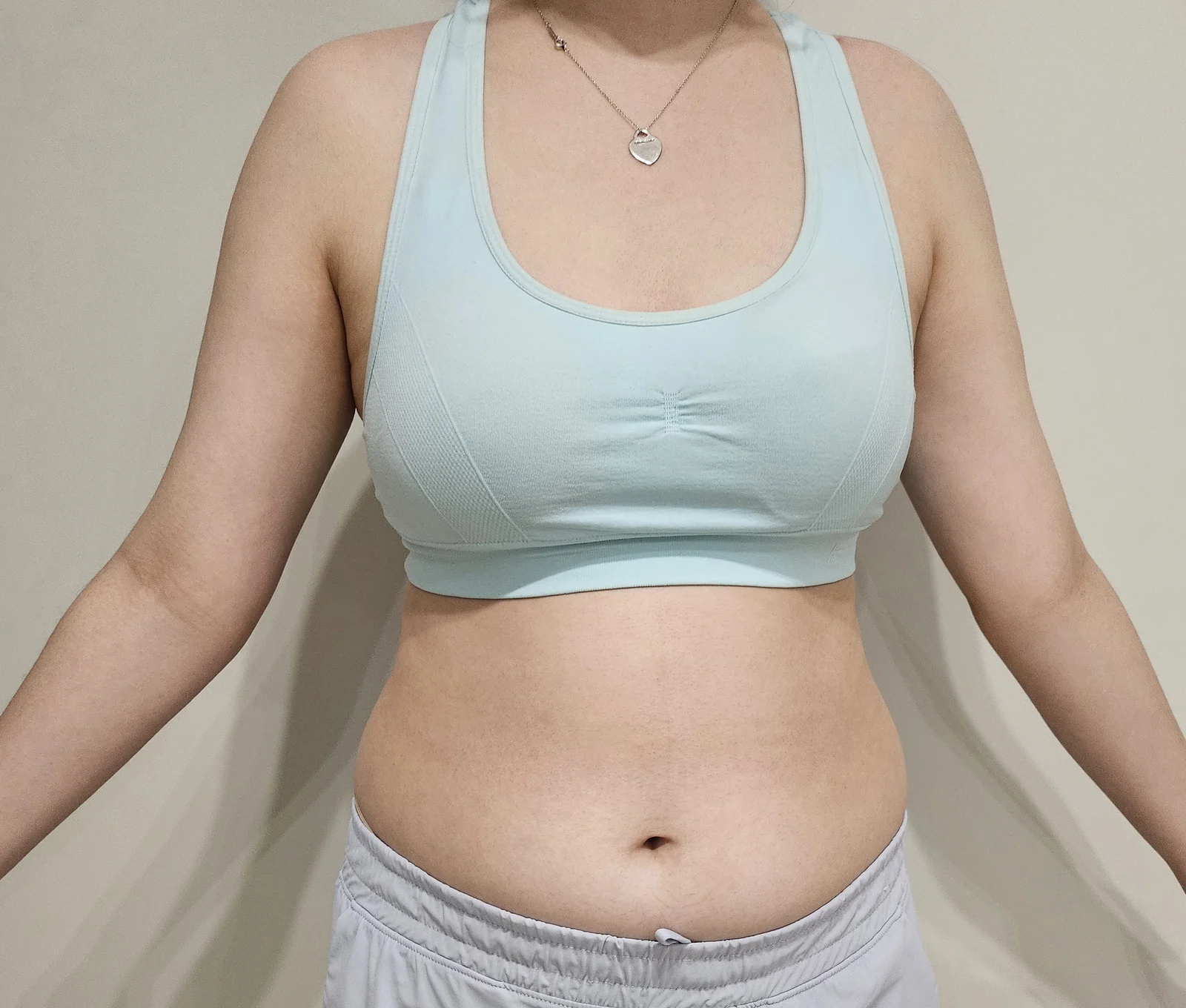 It's been 6 months since my abdomen, lov - Arm Liposuction surgery Before photo - TheLINE Plastic Surgery