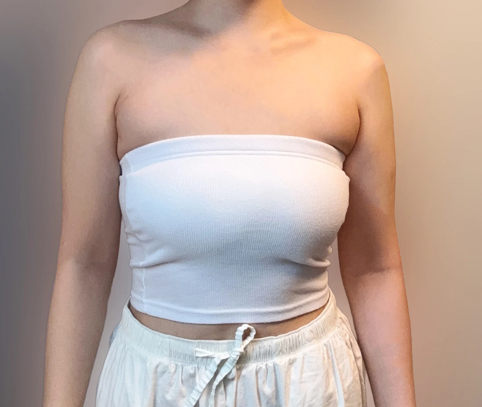 Arm & accessory breast review - Arm Liposuction Before 2 - TheLINE Plastic Surgery