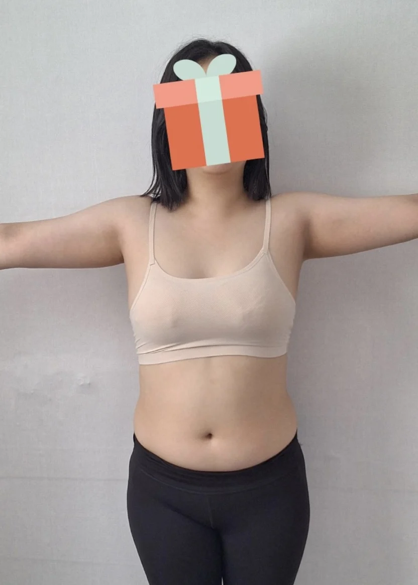 I'm living such a satisfying life - Other Liposuction Before 2 - TheLINE Plastic Surgery